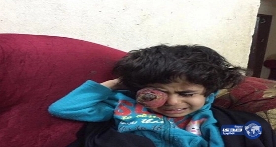 بالفيديو.. «الطفلة لجين» تجتاح «تويتر» بقسوة مرضها