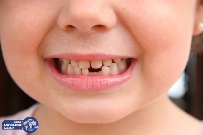هكذا تتصرّفين مع بدء خسارة طفلك لأسنان الحليب