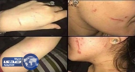 عاملات كوافير يعتدين بالضرب على شقيقة عريس