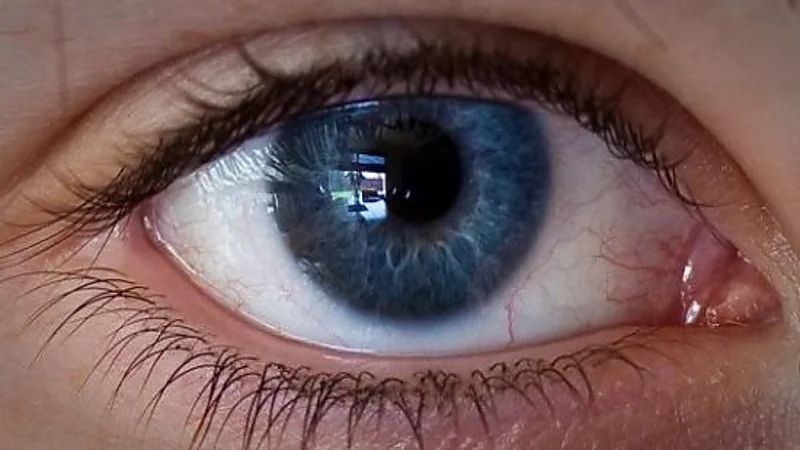 أطباء يتوصلون لطريقة جديدة يمكن من خلالها استعادة البصر