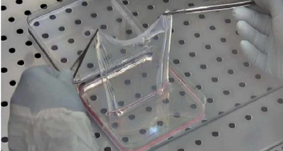 عملية معقدة تنقذ حياة طفل سوري من الموت بألمانيا