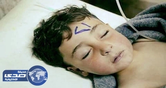 بالصور.. طفل سوري يعود للحياة بعد احتسابه شهيدا