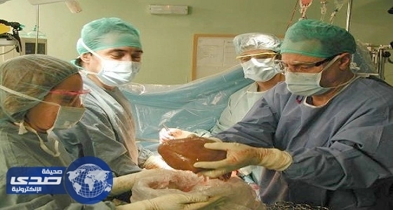 مدير المركز السعودي لزراعة الأعضاء ينفي منع الوافدين من التبرع