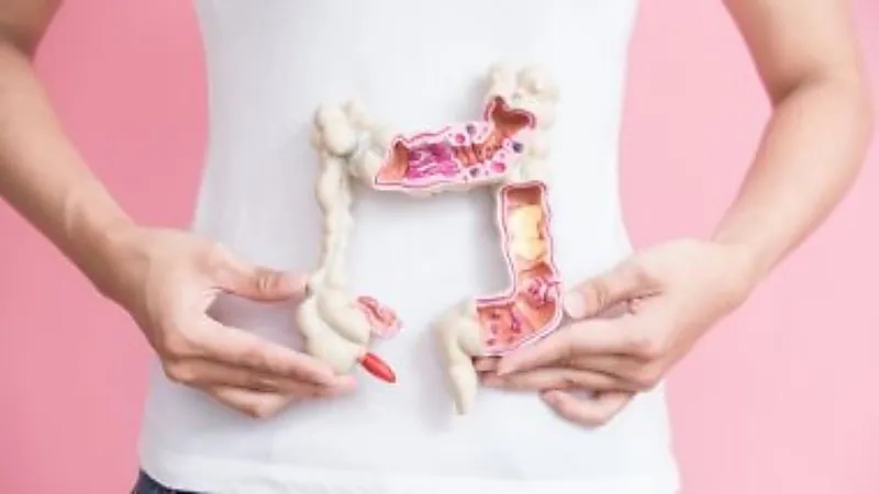 "الخضيري" يوضح أسباب تهيج القولون العصبي وأعراضه