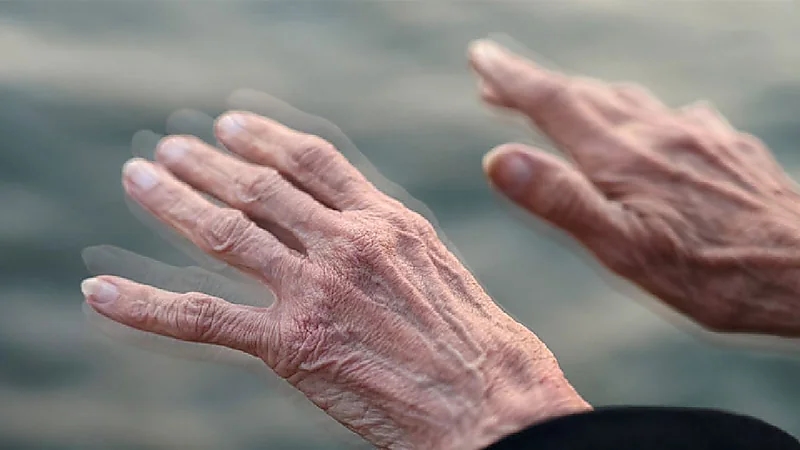 استشاري يوضح أعراض الشلل الرعاش