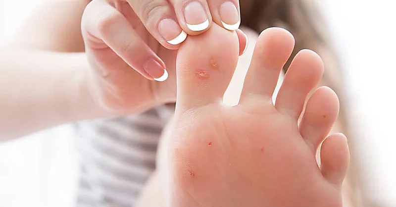 علامات تحذيرية في القدمين يجب عدم تجاهلها