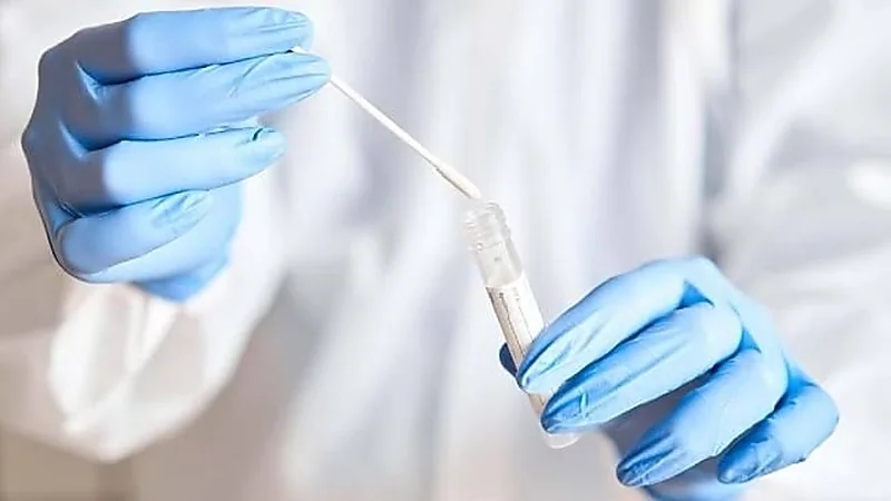 تطوير تطبيق لاختبار الإصابة بالإنفلونزا وكورونا عبر الجوال