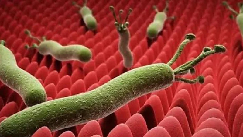 مختص: جرثومة المعدة المسببة للقرحة نشطة وتتطلب علاجاً