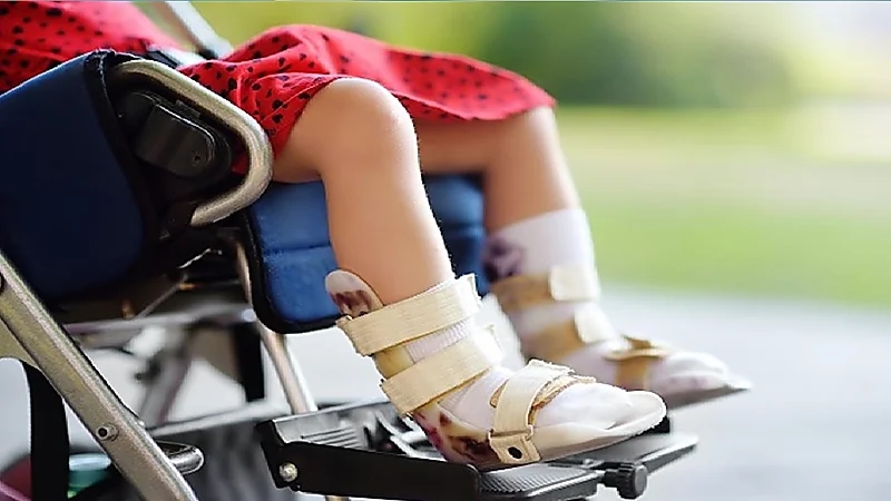 فيروسات شلل الأطفال تجتاح لندن