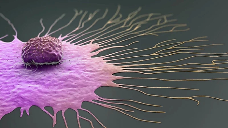 أخصائي أورام يوضح سبب إصابة الرجال بسرطان الثدي