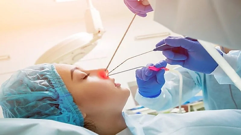 أضرار استخدام الليزر على الأنف.. فيديو