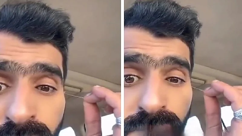 شاب يعاني من حالة غريبة تجعل الخيوط تخرج من عينه! .. فيديو