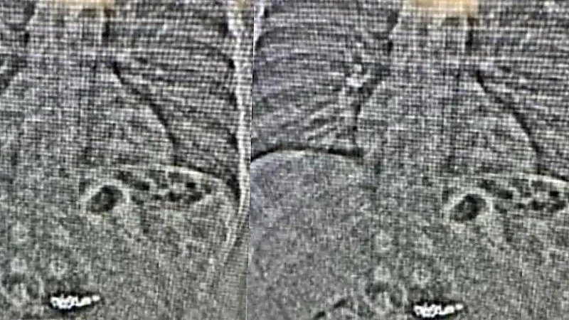 لص يبتلع أقراط ألماس بقيمة 770 ألف دولار