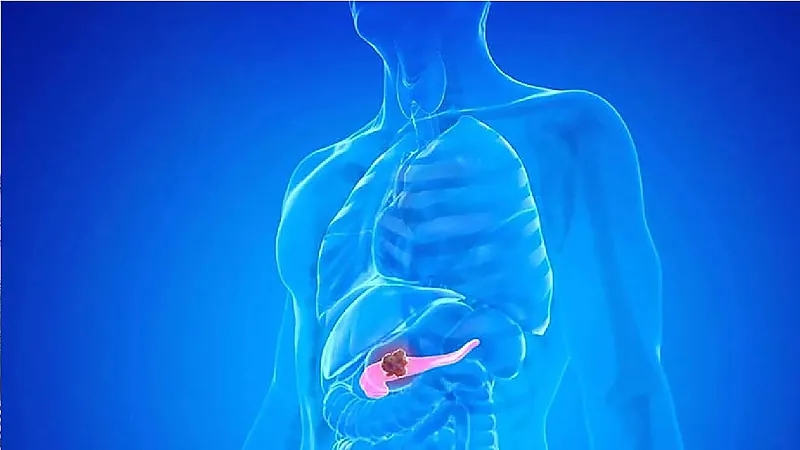 6 أمراض أحد أعراضها ألم الظهر من الجهة اليسرى .. فيديو