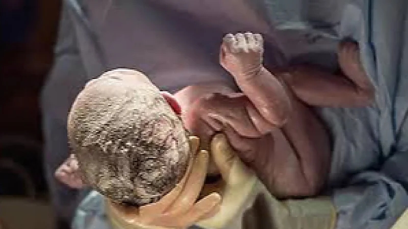 لحظة إخراج الجنين من كيس المشيمة وبداية حياته .. فيديو