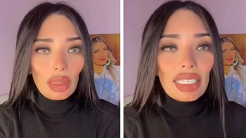 فتاة تنهار بعد تشويه وجهها على يد طبيب تجميل .. فيديو