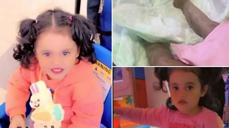 والد الطفلة ضحية الأسيد: لن أتنازل عن حق ابنتي