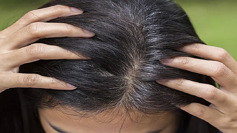 طعام يمنع ظهور الشعر الأبيض