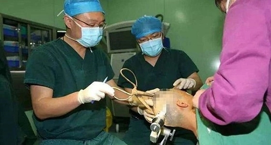 بالفيديو.. مقص يخترق جمجمة سيدة