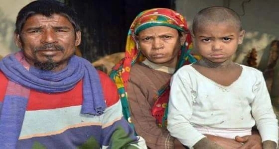 بالصور..طفل يخيف زملائه بسبب تحوله إلى حجر