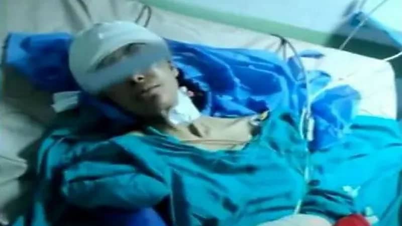 شاهد.. أول صور لاستخراج ساطور من رأس امرأة تعرضت للضرب من ضرتها