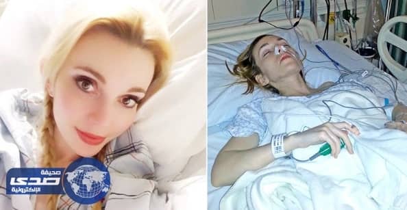 أمريكية تٌعاني من الآلآم مدة 35 عاما .. والسبب " العفن الأسود "