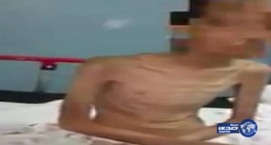 بالفيديو.. الطائرات الروسية تواصل قصف إدلب بالقنابل الفوسفورية والنابلم الحارق