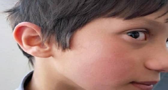 مدير مدرسة ابتدائية في أبها يعتدي على طالبين.. والجهات المختصة تحقق