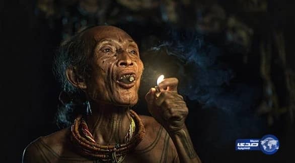 بالصور.. مستشفى الملك سعود للأمراض الصدرية يحتفل باليوم العالمي للأشعة