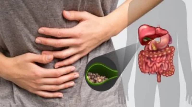 هل يمكن علاج حصوات المرارة بغير الجراحة؟.. طبيب باطنية يُجيب