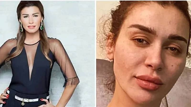 إطلالة صادمة لنادين الراسي بدون مكياج وبوجه شاحب