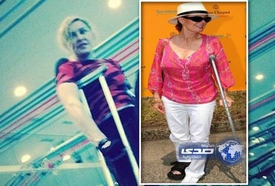 مادونا تمارس الرياضة على عكازين 