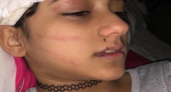 تفاصيل نجاة طفلة السوشيال ميديا من مخالب نمر