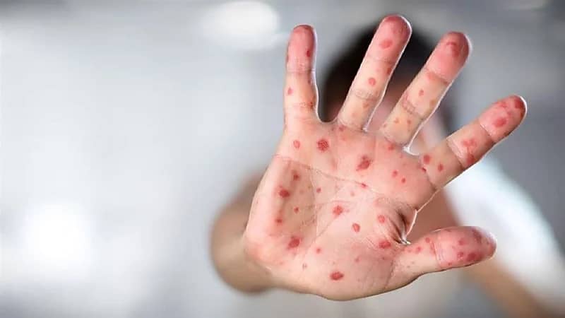 "الصحة العالمية" تحذر من تهديد وشيك في كل منطقة من العالم