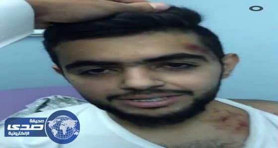 بالفيديو والصور.. لبؤة تهاجم مواطنا في الباحة