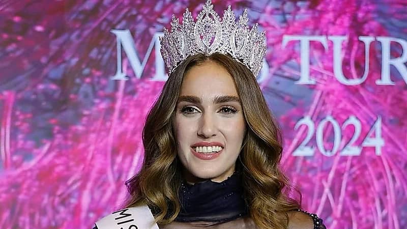 ملكة جمال تركيا تتعرض لحملة تنمر بسبب شكلها .. صور