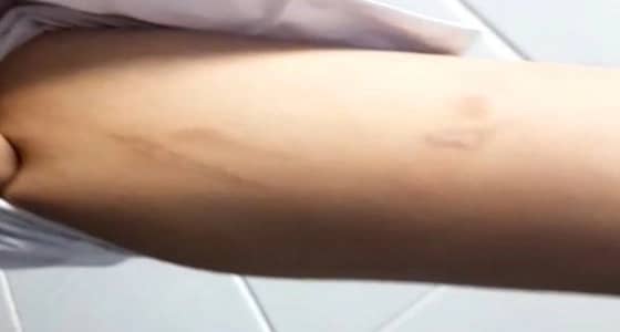 مواطنة تستغيث لإنقاذ ابنتها من عنف زوجة أبيها..و " العمل " تتفاعل