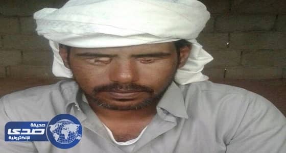 رفض تطليق زوجته فأقتلعوا عينيه