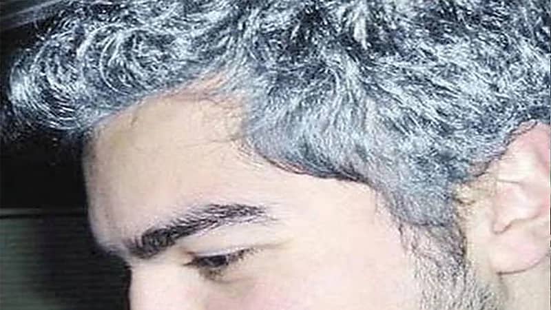 أسباب الشيب المبكر وطرق لتأخير ظهوره