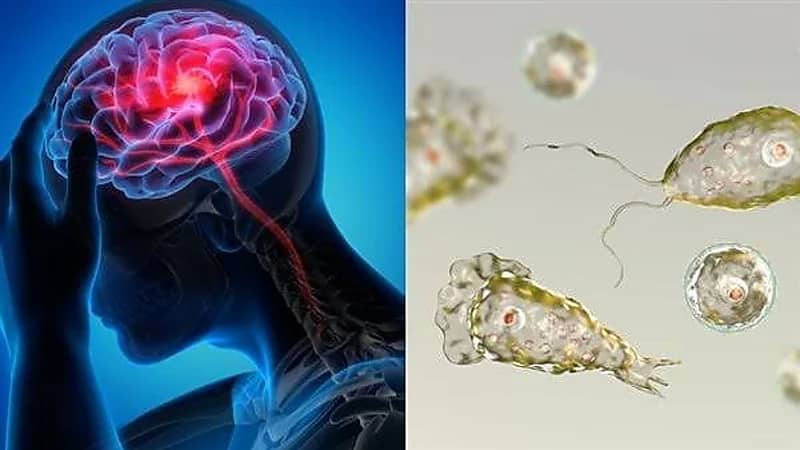 آكلات الدماغ تنهي حياة باكستاني