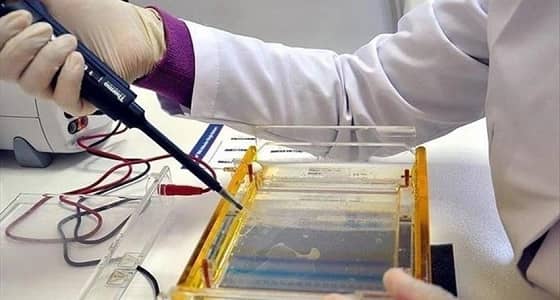 " تروجارزو " دواء جديد لعلاج " الإيدز "