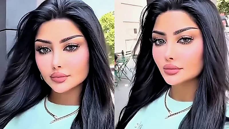 ملكة كابلي تكشف تفاصيل تذويب الفيلر: شفايفي رجعت طبيعية بعد خطأ طبي.. فيديو