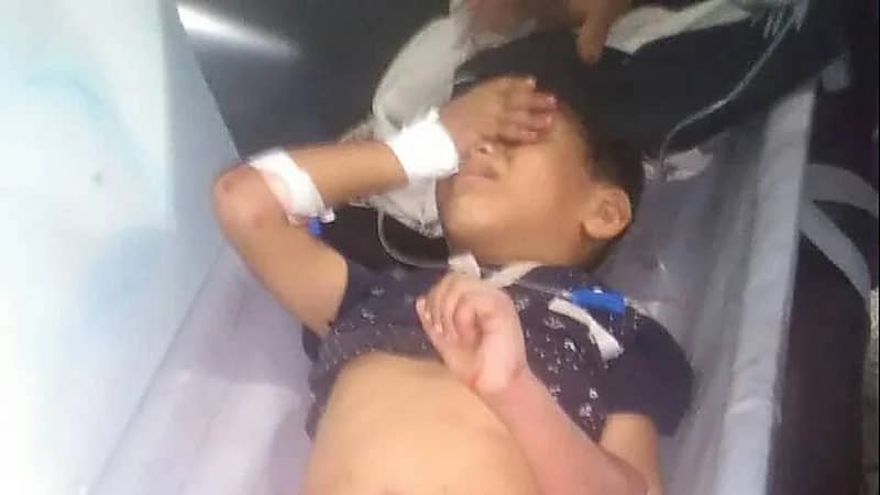 مقتل 3 أطفال بنيران حوثية في " إب "