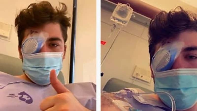 شاب يصاب بالعمى بعد نومه بالعدسات اللاصقة