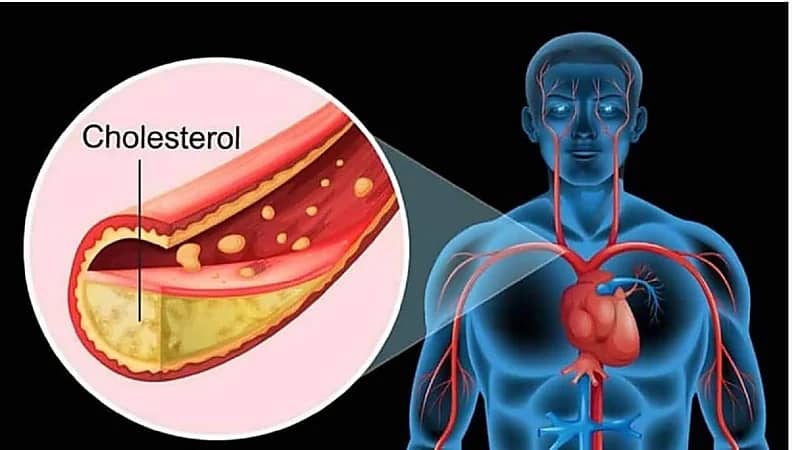 خطورة الدهون الثلاثية وطرق تجنبها والتخلص منها