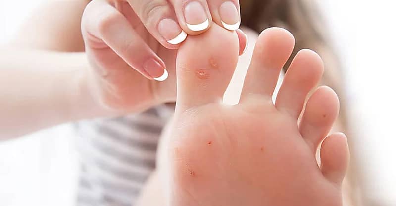 علامات تحذيرية في القدمين يجب عدم تجاهلها