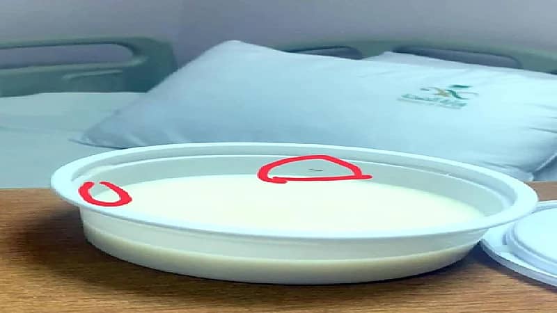 شكوى ضد مستشفى أطفال بالطائف بسبب وجبة حساء بالديدان