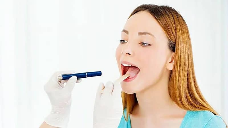 طرق منزلية للتخلص من اللسان الأبيض