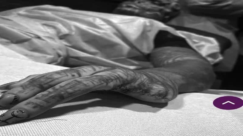 بالفيديو.. شاب يقطع أصابعه ويشق لسانه ليشبه الكائنات الفضائية