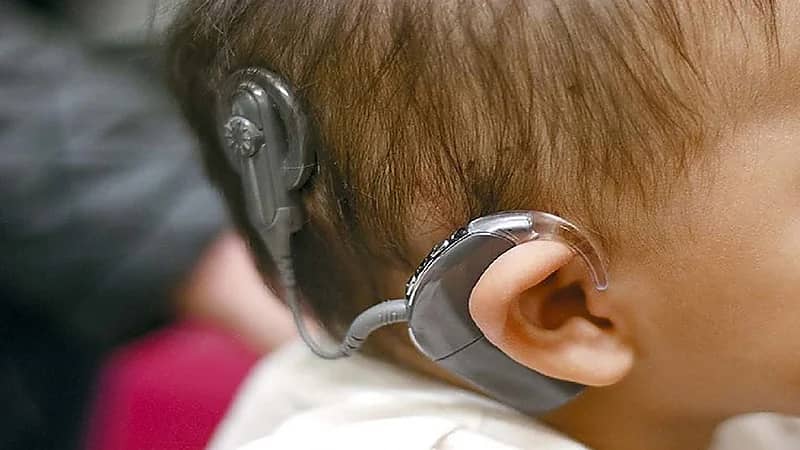 مختص: المملكة تقدم عمليات زراعة القوقعة مجاناً للأطفال